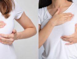 10 Cara Merawat Payudara Agar Tetap Sehat, Kencang, dan Cantik