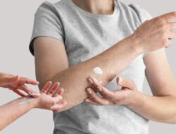 Ini Cara Efektif Mencegah Jamur Kulit Tumbuh dan Menyebar