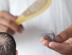 Ini Panduan Dan Cara Mengatasi Kerontokan Rambut